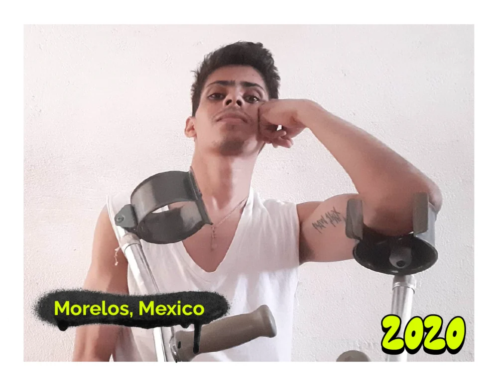 Fotografía de Joven de cabello corto y expresión seria con camiseta blanca sin mangas, apoyado en dos muletas. En la esquina izquierda dice 'Morelos, México', y en la derecha, '2020', sobre fondo negro. La imagen tiene un marco gris